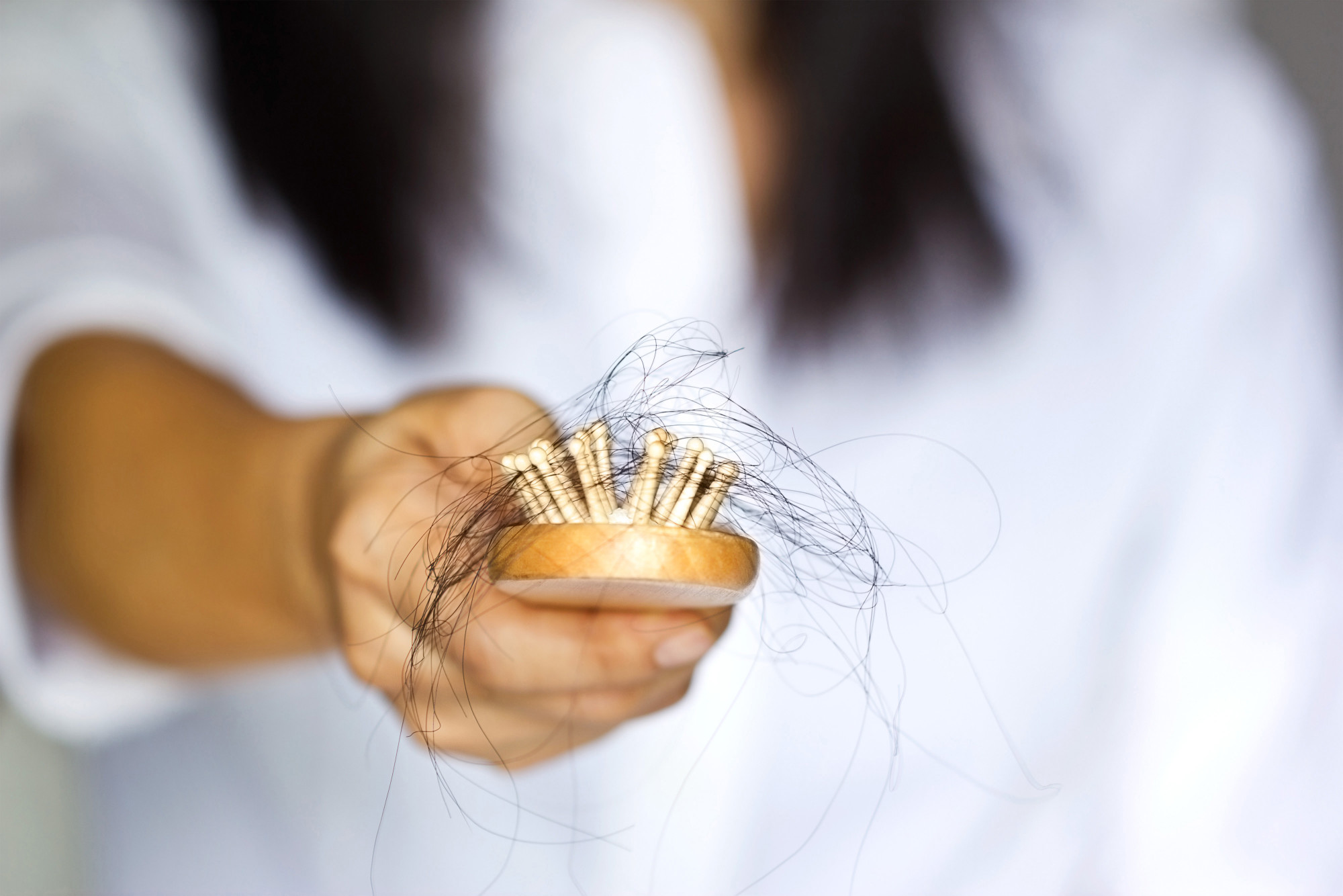 Hair Help: Does RU58841 Regrow Hair? 2 hair