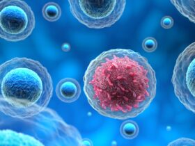 News of inoperable cancer like 'being hit by way of a bus', says husband of woman suing over alleged misinterpretation of smear test 139