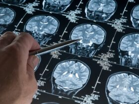 Waterford research shows key role eating regimen plays in Alzheimer's disorder 145