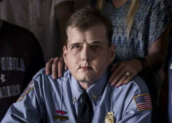 Firefighter Patrick Hardison overjoyed with world’s most extensive facial transplant