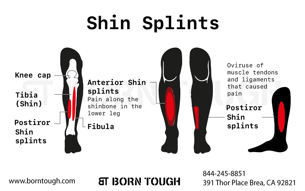 How to Massage Shins Splints? Fit Coachion