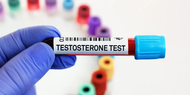 The Best Site to Buy Testosterone Online