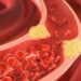 When combating excessive blood cholesterol