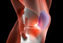 How Typical Is Knee Pain In TCM