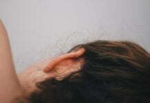 Ringing in the ears – make it stop close-up photo of woman's hair