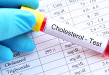Cholesterol Tests – What Exactly Are They Used For?