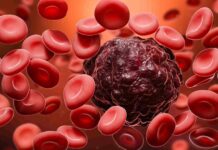 Blood Cancer Treatment – Natural Cure in the Next 10 Years
