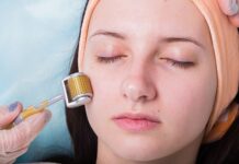 Transform Your Skin: Micro Needling Before and After