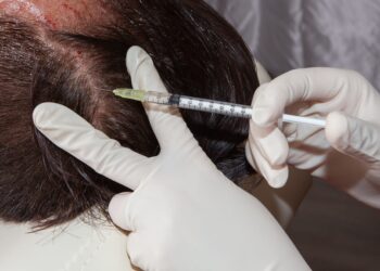 Laser Caps and Hair Loss Treatment