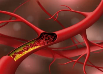 Cholesterol Good And Bad