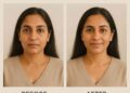 From IV to Topical: The Rise of NAD⁺ in Skincare Products