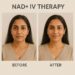 From IV to Topical: The Rise of NAD⁺ in Skincare Products