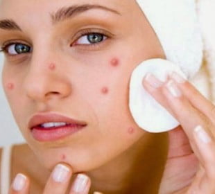 Your monsoon splendor survival kit 9