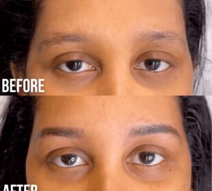 Revitalize Your Brows with Our Serum 4