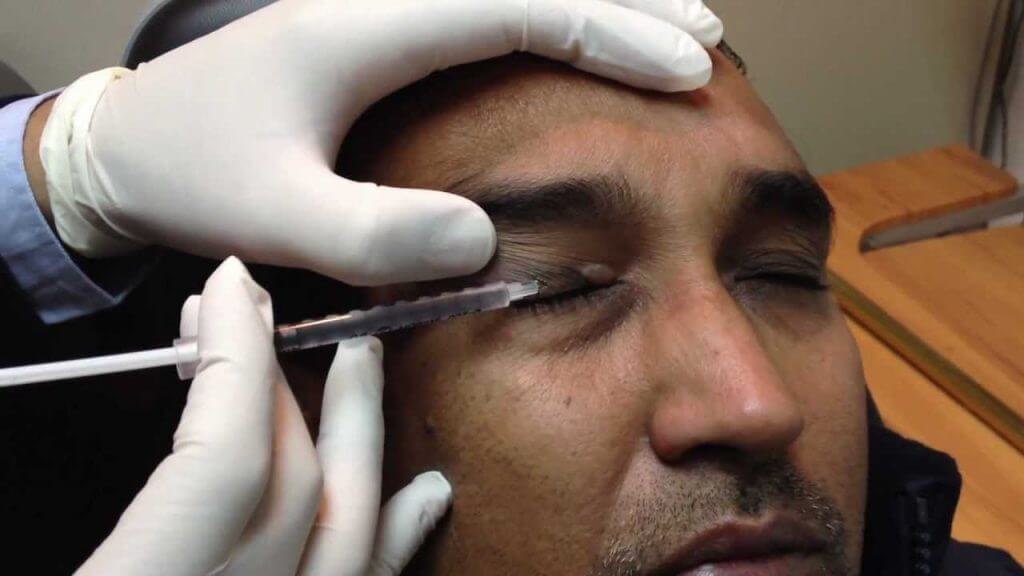 Eye Twitch Remedies: How to Stop Eye Twitching 1