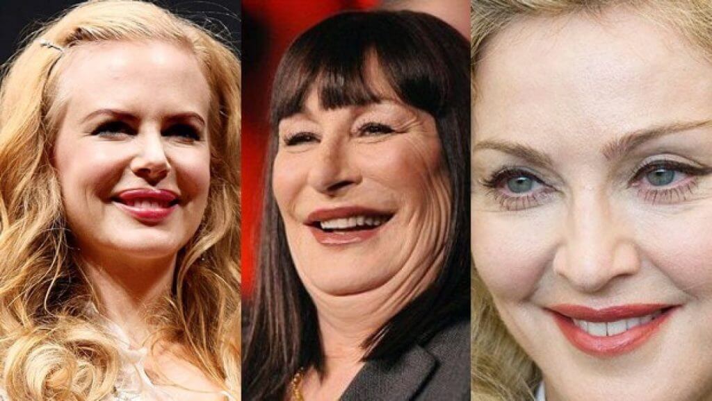 Negative Effects of Plastic Surgery 3