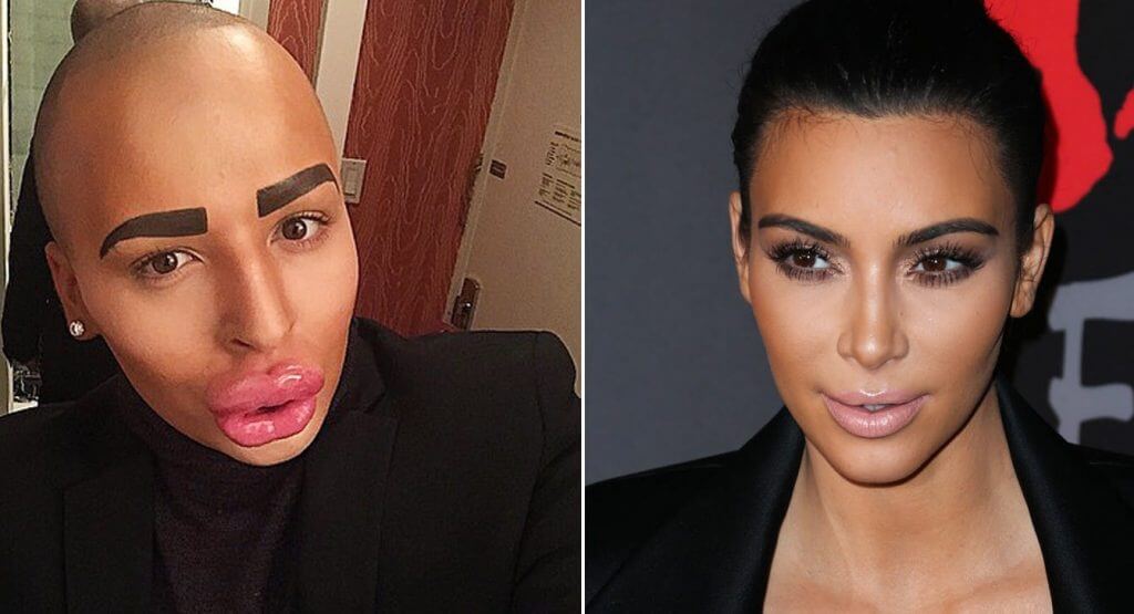 Facts About Cosmetic Surgery 3