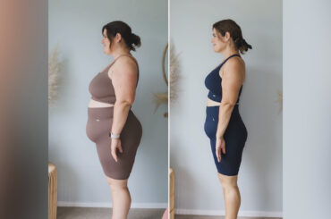 How Effective Is Weight Loss Surgery? 4