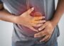 What is Peptic Ulcer 3 What is Peptic Ulcer 2