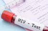 HIV-AIDS - Immunity, Eradication and Its Disappearing Victims 12