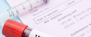 HIV-AIDS - Immunity, Eradication and Its Disappearing Victims 12