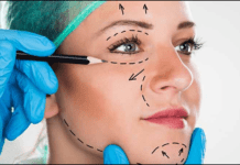 Essential Cosmetic Surgery Tips That You Must Consider