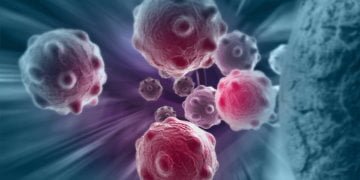 Nonprofit companions with Northwell on breast cancer services for sufferers