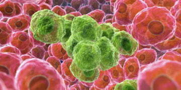 Are doctors treating extra thyroid most cancers patients than necessary?