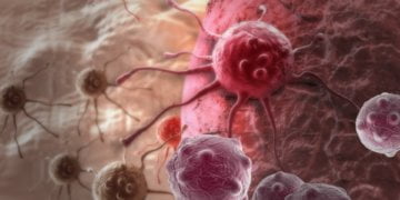 Addicted to ran, ovarian most cancers cells stop shifting whilst disadvantaged