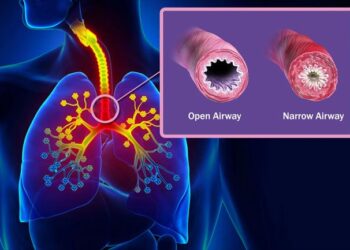 Beta Blockers with Asthma – How to Treat Asthma Without Drugs
