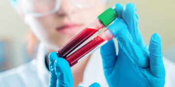 Symptoms of Blood Cancer