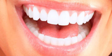 The Best Toothpaste for Healthy Teeth