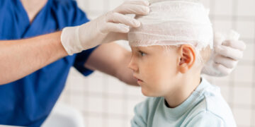 Head Injury of Child – How to Treat a Child After a Brain Injury