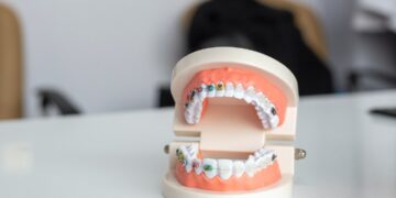 Smiling with Confidence: How Headgear Braces Can Transform Your Smile