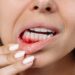 Essential Tips For Preventing Gum Disease