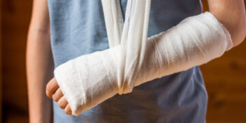 What To Do If You Think A Bone Is Broken: Quick and Easy Help