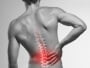 Physiotherapist, physiotherapy near me, back pain