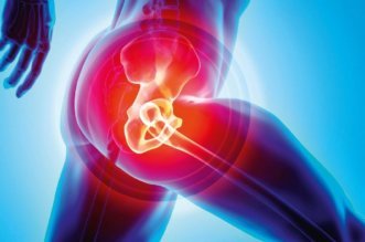 What Products to Use After Having Hip Surgery to Ensure Safety 1