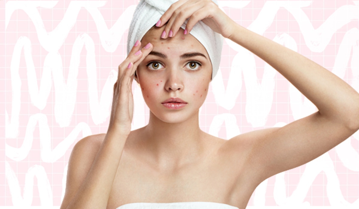 Facial Bumps A Complete Guide for Beginners Style Spire