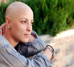 Protein connected to competitive pores and skin most cancers 52