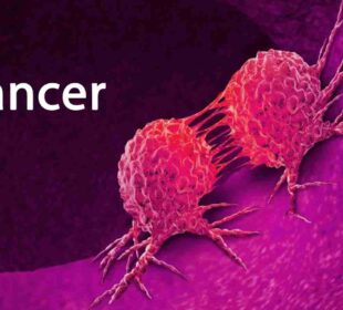 Breast Cancer Metastasis - How Does it Work? 65 Breast Cancer Metastasis - How Does it Work? 54