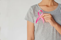 ICD 10 for Breast Cancer 53