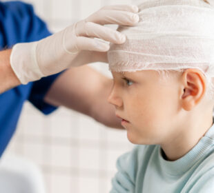 Head Injury On A Child 67 Head Injury On A Child 58