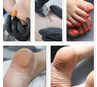 Revitalize Your Feet with Medical Pedicures 55