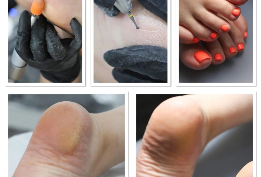 Revitalize Your Feet with Medical Pedicures 49 Revitalize Your Feet with Medical Pedicures 49