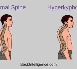 Say Goodbye to Dowager's Hump: 5 Effective Ways 52