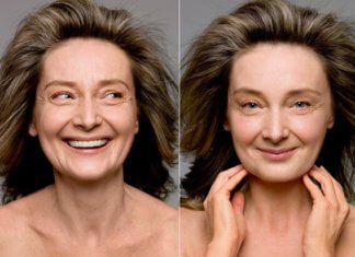 Benefits of Skin Tightening Therapy