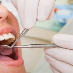 Essential Tips For Selecting A General Dentist 40