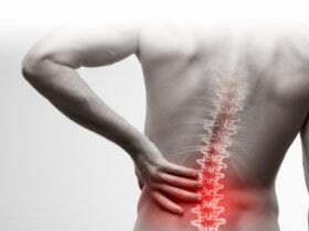 Causes of Back Pain 38 Causes of Back Pain 38