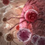 Surviving most cancers may also rely upon wherein you live inside the global 39